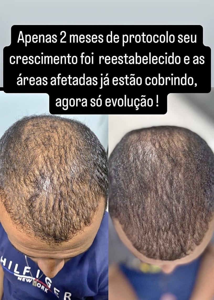 Tratamento capilar - Antes e Depois