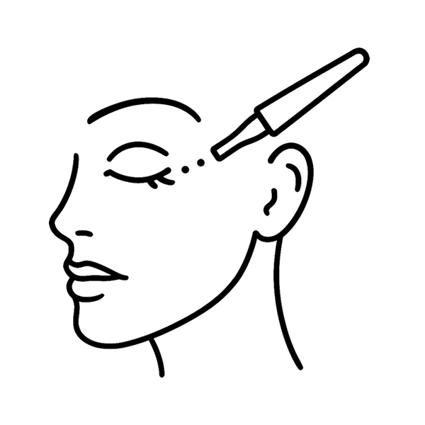 Blefaroplastia sem Corte